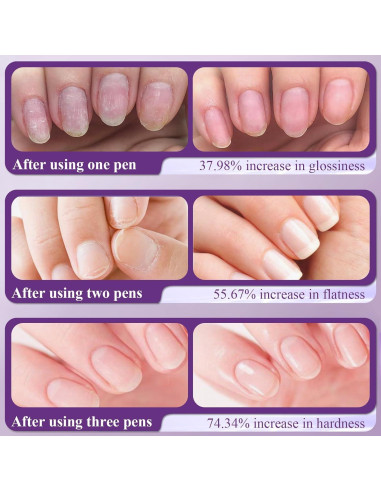 Bolígrafo de Aceite para Cutículas 3 en 1 Plman - Cuidado de Uñas