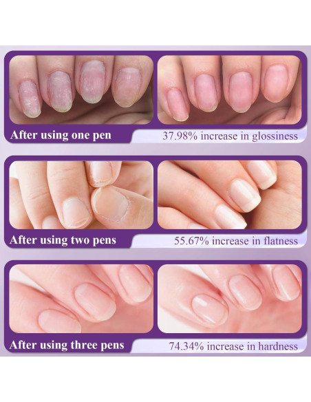 Bolígrafo de Aceite para Cutículas 3 en 1 Plman - Cuidado de Uñas