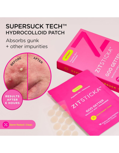 Parche Hidrocoloide ZitSticka Goo Getter 72 Piezas para Granos