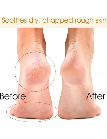 Calcetines Hidratantes Sin Dedos CIATBYYJ - 6 Pares para Talones Agrietados