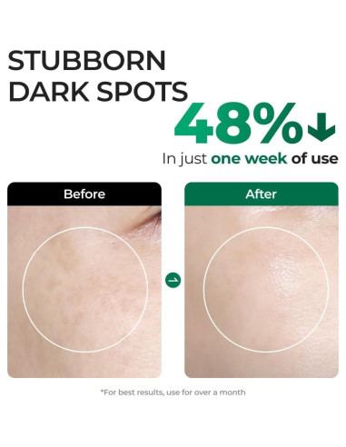 Sérum Corrector de Manchas Oscuras EASYDEW EGF 27.93 ml