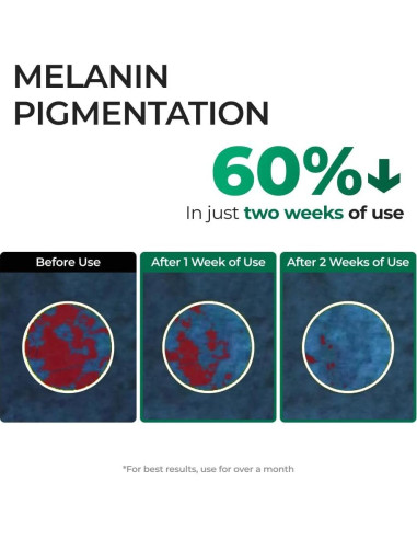 Sérum Corrector de Manchas Oscuras EASYDEW EGF 27.93 ml