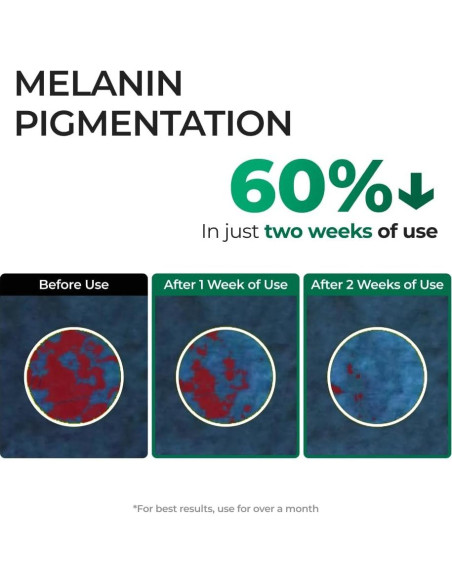 Sérum Corrector de Manchas Oscuras EASYDEW EGF 27.93 ml