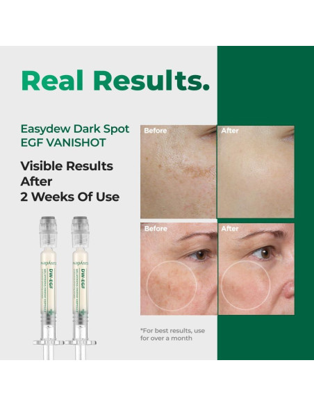 Sérum Corrector de Manchas Oscuras EASYDEW EGF 27.93 ml