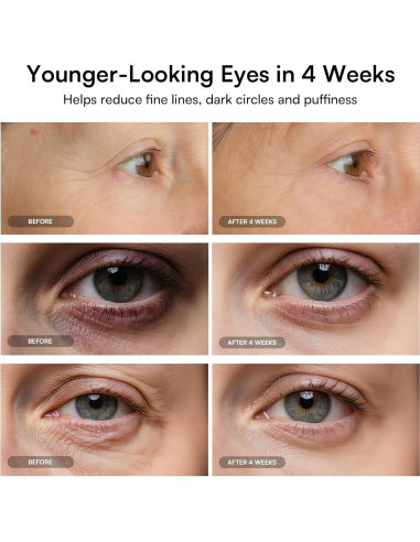 Máscara de Terapia de Luz Roja INIA para Ojos - Antienvejecimiento