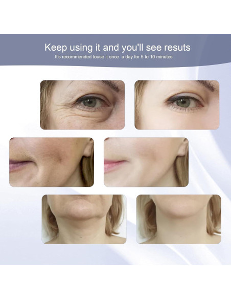 Masajeador Facial WOWPASS con Luz LED 7 Colores para Piel