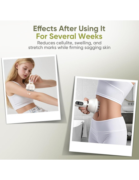 Masajeador Drenaje Linfático REDLOOK 005K Blanco - Anticelulitis