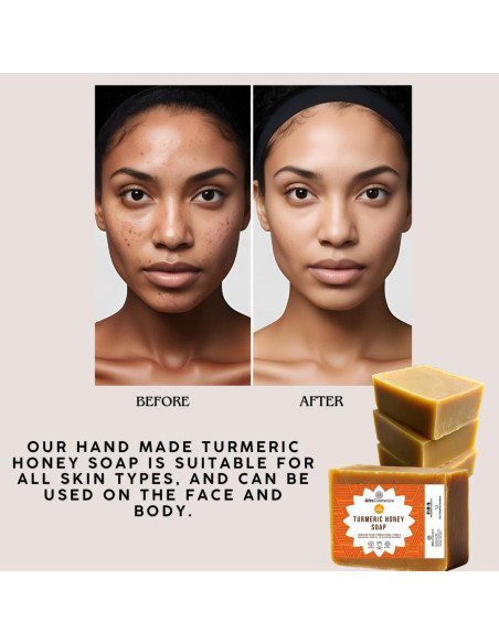 Jabón de Barra de Miel y Cúrcuma Afro Cosmetics 113 g