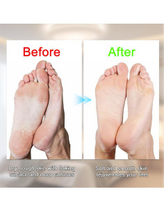 Pulidor Eléctrico de Pies FOTN DDMJJ USB Recargable Naranja 2