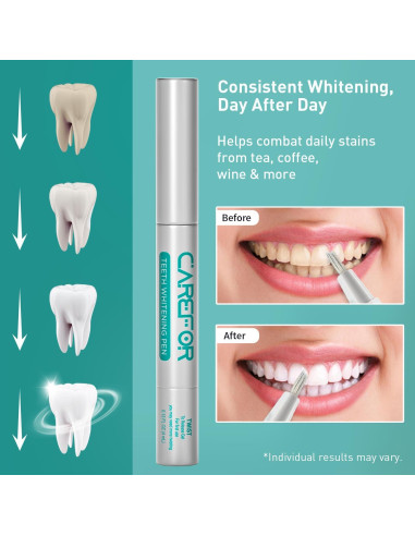 Bolígrafo Blanqueador de Dientes Onuge 2 Piezas 8ml Gel Rápido