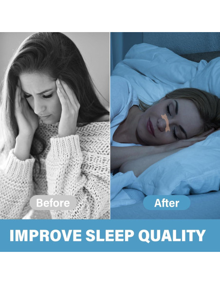 Tiras Nasales Antironquidos NECALON - 100 Pcs Alivio Congestión