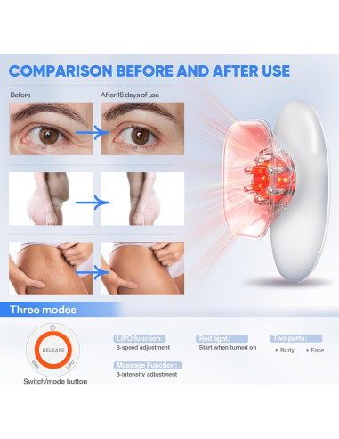 Masajeador Eléctrico de Celulitis 3-en-1 Ciyada - Blanco