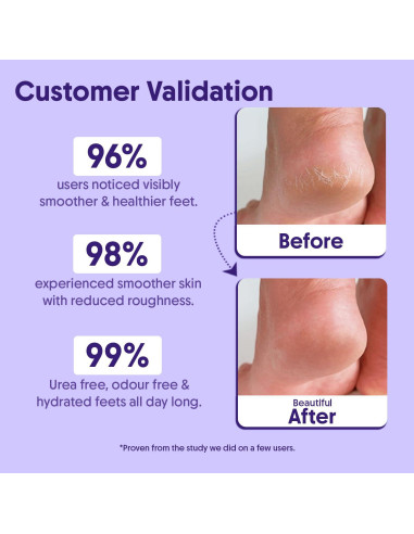 Rodillo Exfoliante para Pies Aravi AHA BHA 50ml - Suaviza y Repara