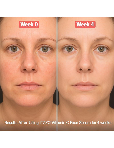 Suero Facial Antienvejecimiento ITZZO 30ml - Vitamina C, Ácido Hialurónico, Retinol