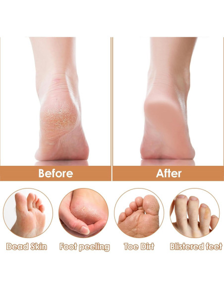 Raspador de Pies Mabor de Madera con Lima para Callos Negro