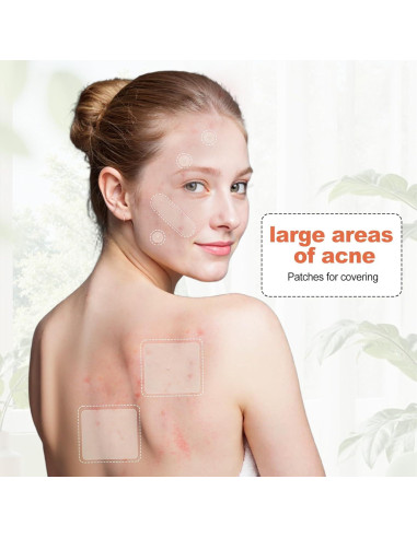Parche Hidrocoloide para Acné Cabiuty - 68 Parches de 3 Tamaños