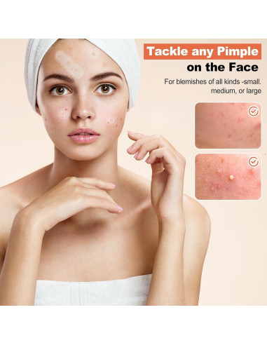 Parche Hidrocoloide para Acné Cabiuty - 68 Parches de 3 Tamaños