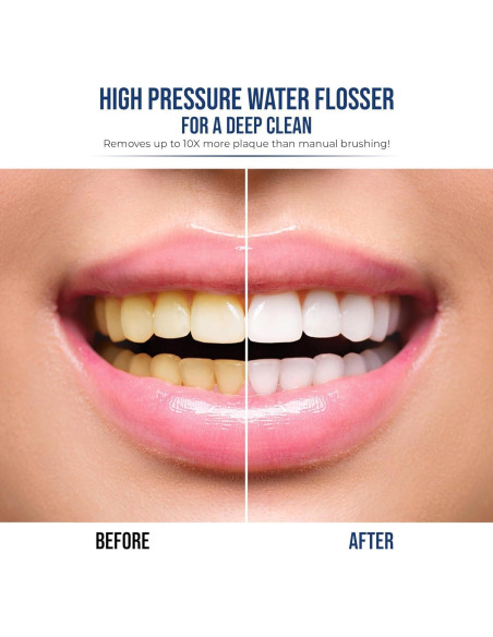 Cepillo de dientes eléctrico 2 en 1 Synergy Brands - Hilo dental y 40k vibraciones