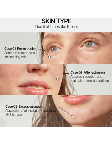 Parche Hidrocoloide Parnell Cicamanu para Acné - 68 Unidades