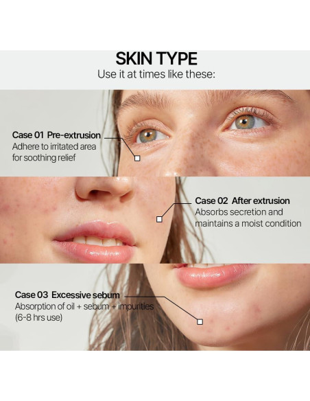 Parche Hidrocoloide Parnell Cicamanu para Acné - 68 Unidades