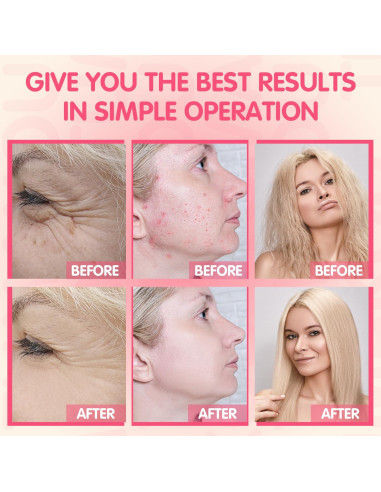 Máquina Facial de Alta Frecuencia TUMAKOU Naranja 4 Tubos