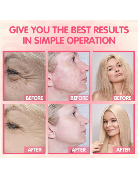 Máquina Facial de Alta Frecuencia TUMAKOU Naranja 4 Tubos