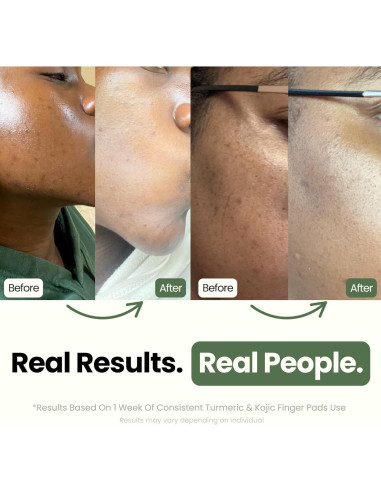 Almohadillas de Limpieza Exfoliantes Olahoni - 30 Unidades