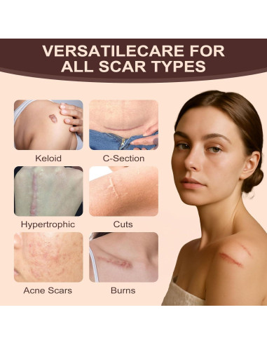 Stick de Silicona para Cicatrices RIWYDMA 60% 20g