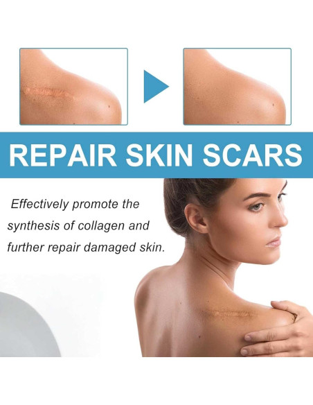 Stick de Silicona para Cicatrices RIWYDMA 60% 20g