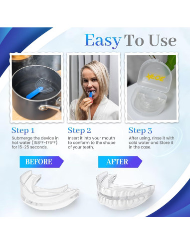 Protectores Nocturnos AFOE para Bruxismo - Doble Moldeo, 2 Unidades