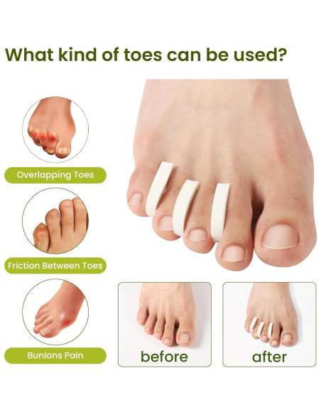 Separadores de Dedos de Espuma Bukihome - 44 Piezas Suaves y Transpirables