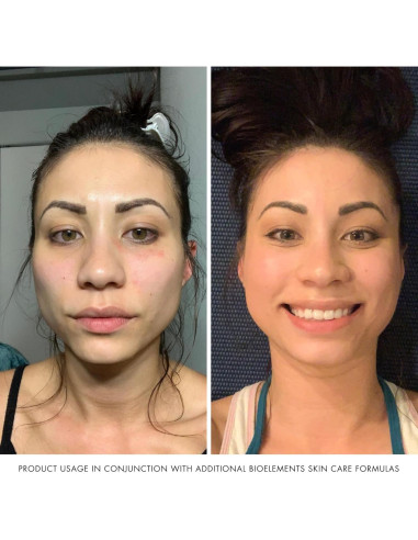 Limpiador Espumoso Bioelements 192.5 ml para Piel Mixta