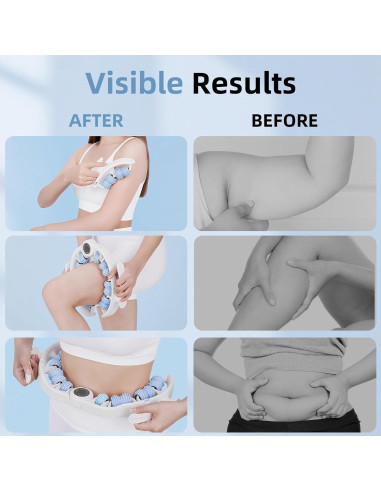 Rodillo de Masaje Anticelulitis LOTPICK Azul 25.9x25x4cm