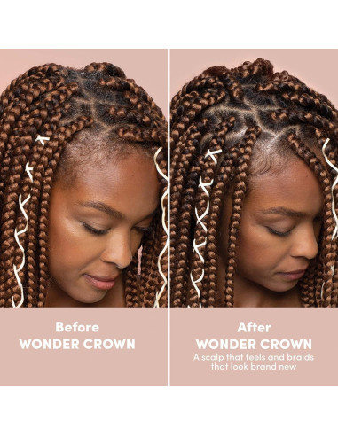 Limpiador de cuero cabelludo Mizani Wonder Crown 272g - Estimula crecimiento