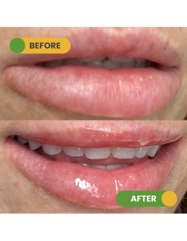 Dúo Labial Hidratante y Exfoliante Nuzilicious - Mango