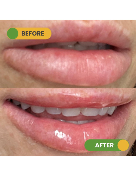 Dúo Labial Hidratante y Exfoliante Nuzilicious - Mango