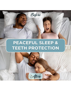 Protector Bucal Nocturno ELSOPHIE Ajuste Personalizado 4 Paquete 2