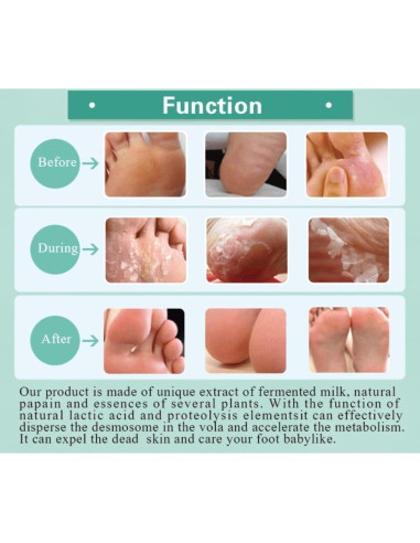 Mascarilla Exfoliante para Pies HODAF - 2 Paquetes, Suaves y Rejuvenecidos