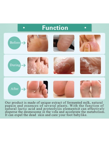 Mascarilla Exfoliante para Pies HODAF - 2 Paquetes, Suaves y Rejuvenecidos