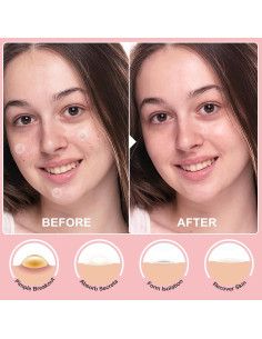 72 Parches Hidrocoloides para Acné Invisibles - Cuidado Facial 2