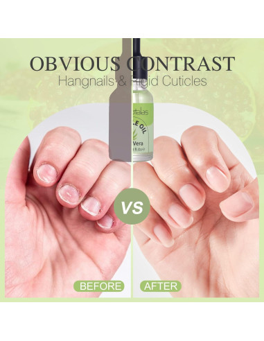 Aceite para Cutículas Foriotalas 15ml Jojoba Aloe Vera Hidratante