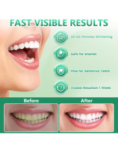 Tiras Blanqueadoras de Dientes Milumber para Sensibles - 42 Tiras 2