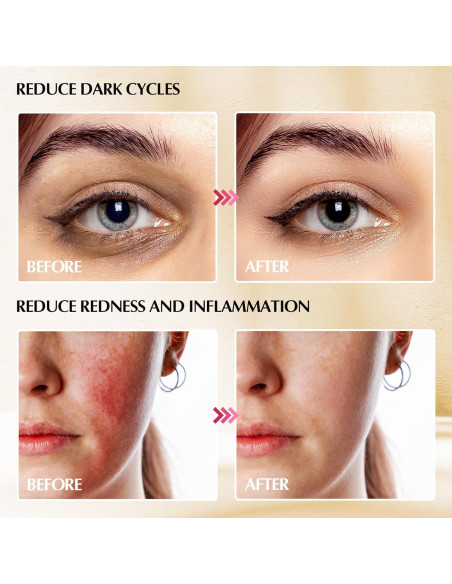 Gua Sha Cryo Sticks Fabludo Acero Inoxidable 2-en-1 Facial