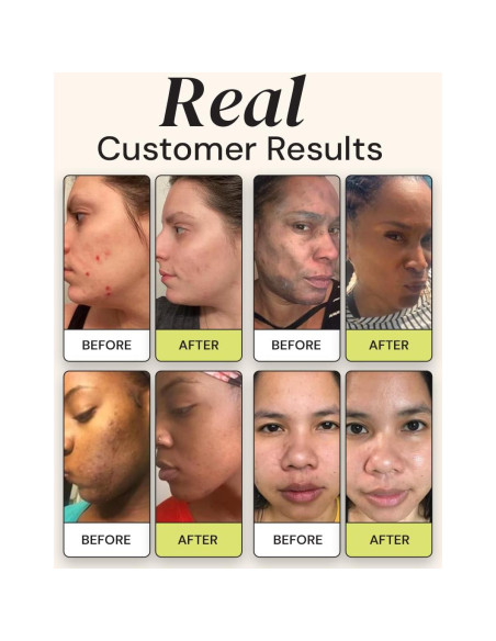 Dúo Hidratante Gleamin - Mascarilla de Arcilla y Crema Iluminadora