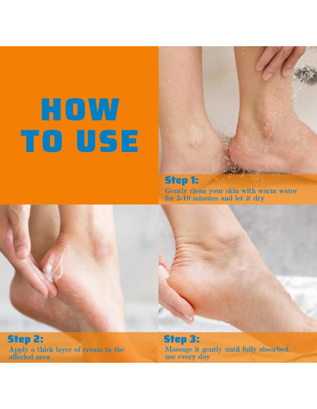 Crema de Urea 60% YOUNGYOUNGLOVE para Pies y Manos 248g