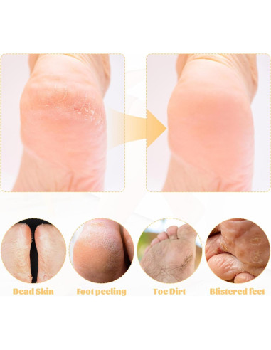 Removedor de Callos de Madera y Piedra Corindón JJUNW 22cm