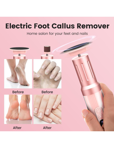 Removedor de Callos Eléctrico Slyhaw 2 en 1 Rosa 2000RPM