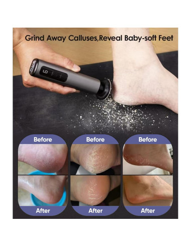 Removedor de Callos Eléctrico 9 Velocidades USB Gris Oscuro