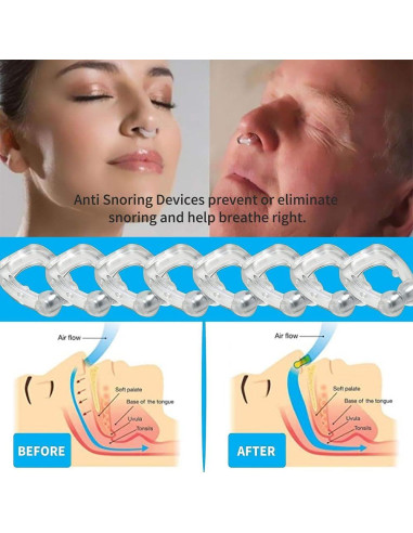 Dispositivos Anti Ronquidos SDGFE33, Clips Nasales de Silicona