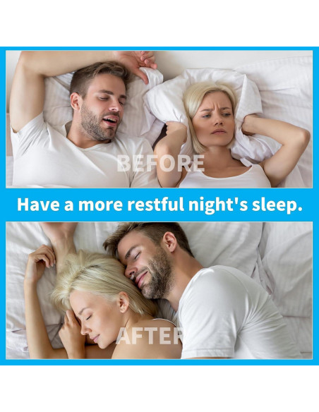 Dispositivos Anti Ronquidos SDGFE33, Clips Nasales de Silicona